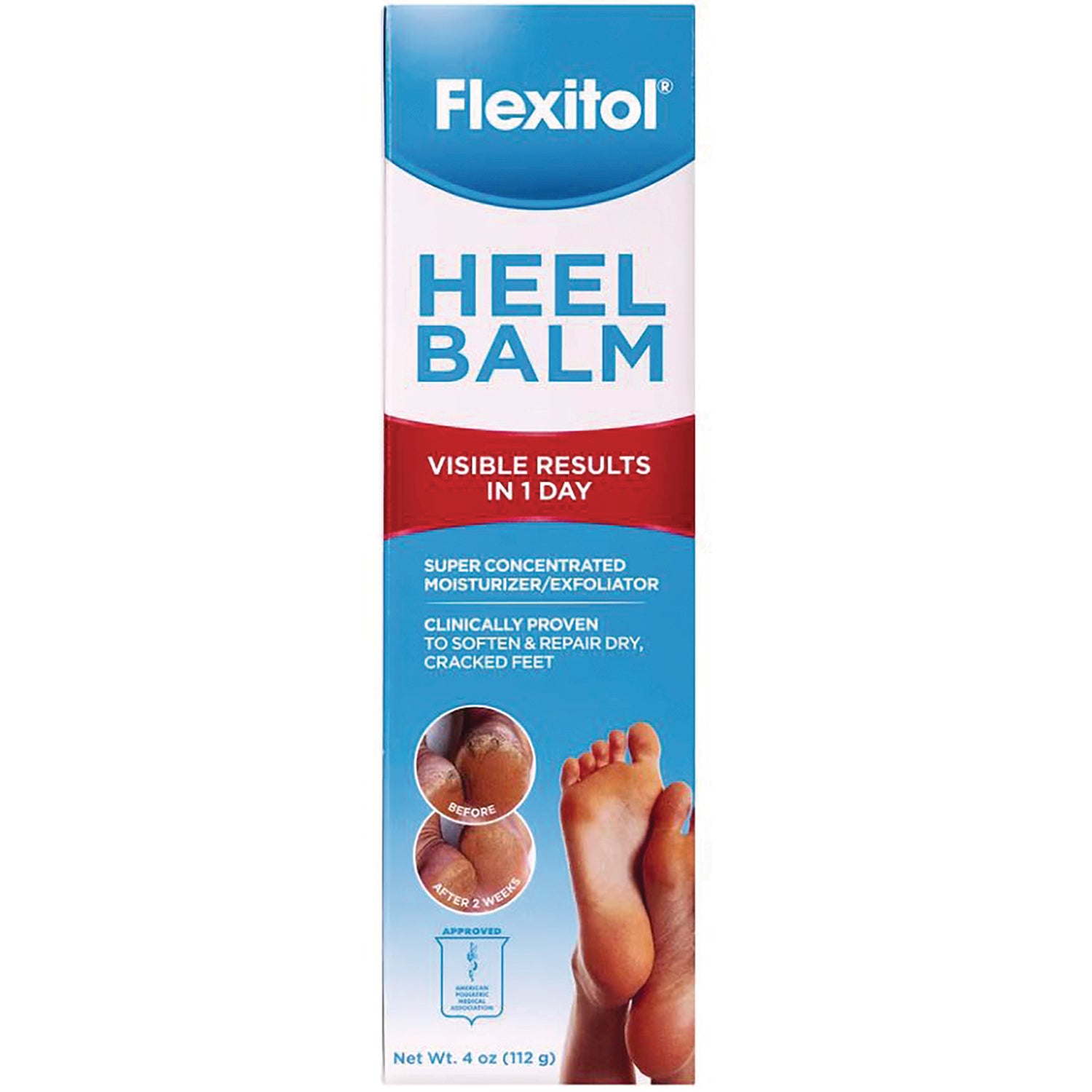 MS662 | Flexitol Heel Balm front packaging showing product name, visible results in 1 day claim and before/after feet images